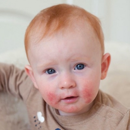 Най-нежната първа грижа за суха и много суха кожа, склонна към атопия